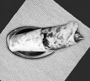 Egg roll