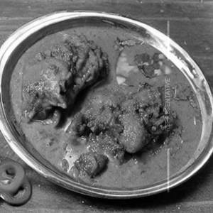 Chicken dahiwala