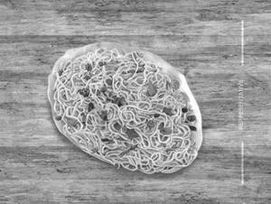 Egg Noodles