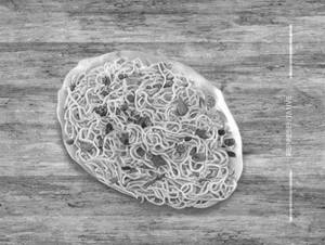 Egg Noodles