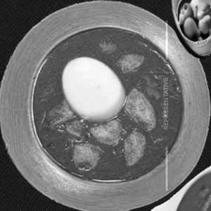Egg Sangam Curry