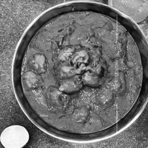 Malai Matar JAIN