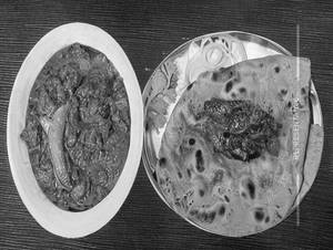 Baingan Bhartha