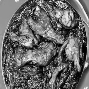 Chicken Palak