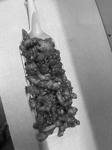Chicken Crispy