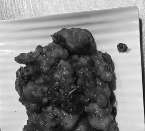 Xian Chicken