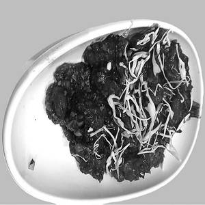 Mushroom Manchurian Dry