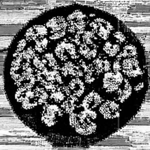 Mushroom Schezwan (Dry / Greavy)