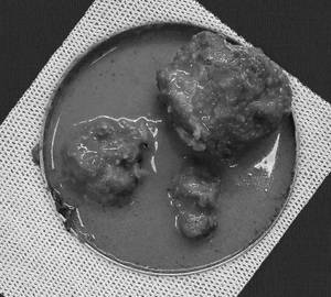 Veg Kofta