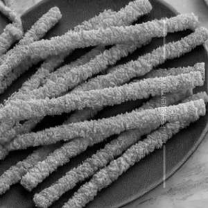 Crunchy Potato Sticks