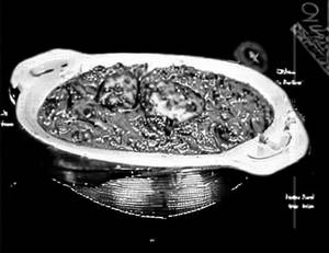 Palak Kashmiri Kofta
