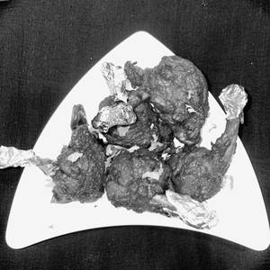 Chicken Lollipop