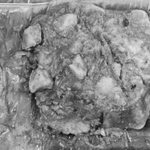 Chicken Elai Porotta