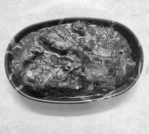 Gongura Chicken