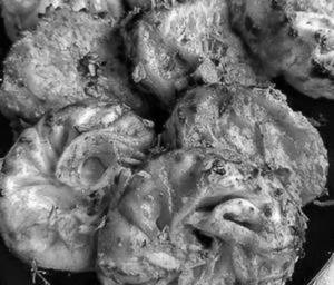 Mushroom Momos