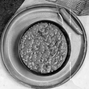 Dal butter fry
