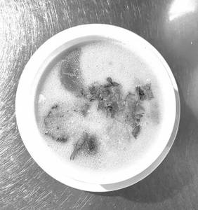 Mushroom Soup Chicken