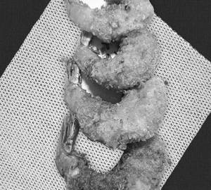 Golden fried prawn  [5 pcs]