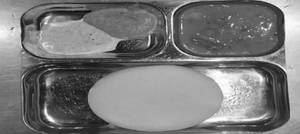 Thattu Idli