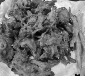 Khekada Pakoda