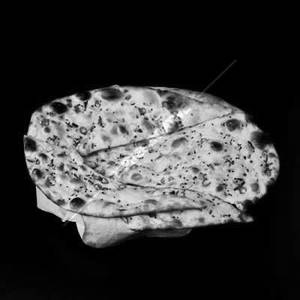 Mixed Naan