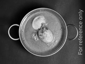 Egg Curry