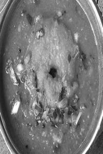 Sambar Vada