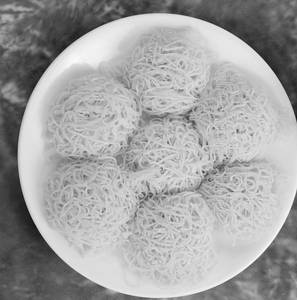 Idiyappam